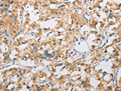 ATG4C antibody