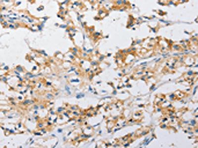 ATG4C antibody