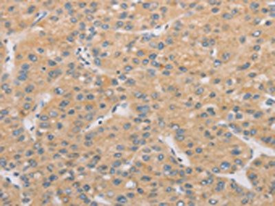 ATG4D Antibody