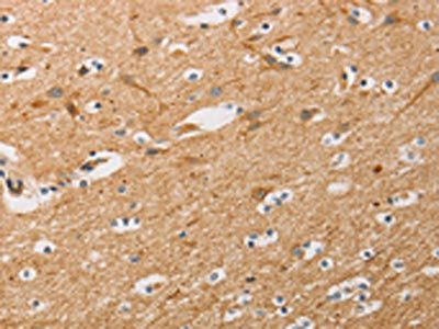 ATG4D Antibody