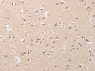 ATG9A Antibody