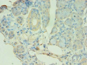 ATG9B antibody