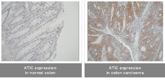 ATIC antibody