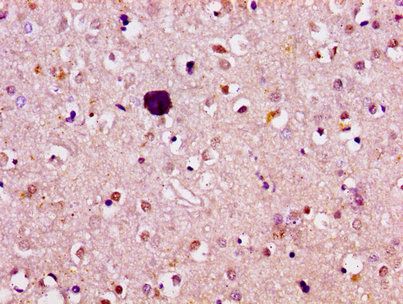 ATL1 Antibody