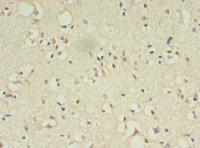 ATL3 Antibody