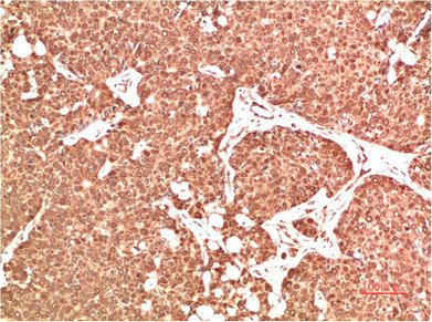 ATM antibody