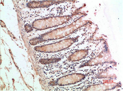 ATM antibody