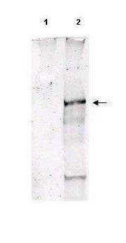 ATM (phospho-S1981) antibody