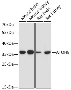 ATOH8 antibody