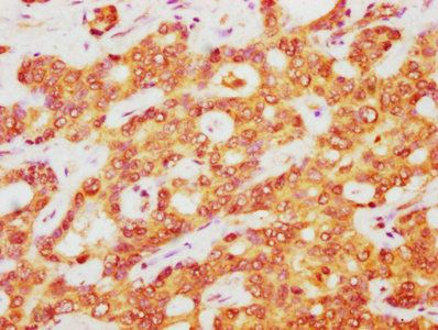 ATOX1 Antibody