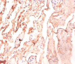 ATP5F1D Antibody