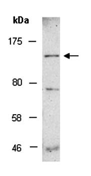 ATP11A (M2) Antibody, Rabbit Polyclonal
