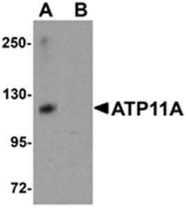 ATP11A Antibody