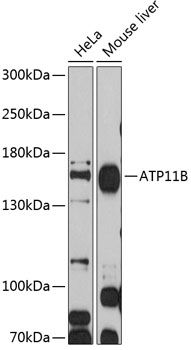 ATP11B antibody