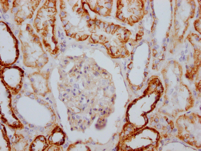 ATP1A1 Recombinant Monoclonal Antibody