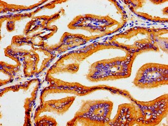 ATP1B1 Antibody