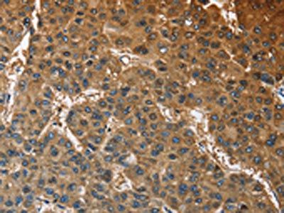 ATP1B2 Antibody