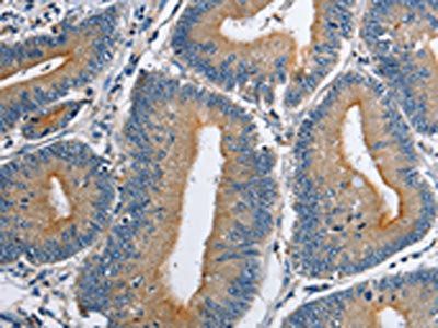 ATP1B2 Antibody