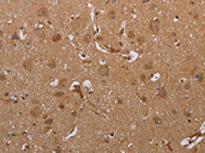 ATP2A1 Antibody