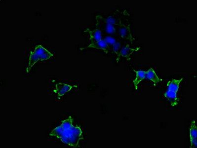 ATP2B2 Antibody