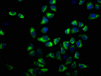 ATP2B3 Antibody