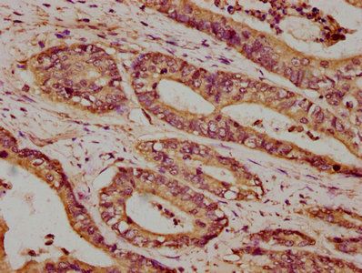ATP2B4 Antibody