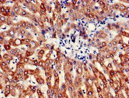 ATP5B Antibody