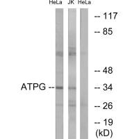 ATP5C1 Antibody
