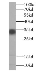 ATP5C1 antibody