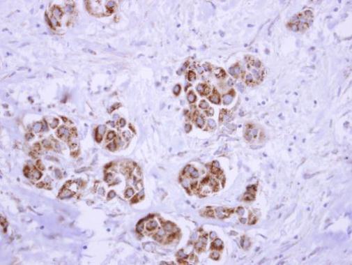 ATP5D antibody
