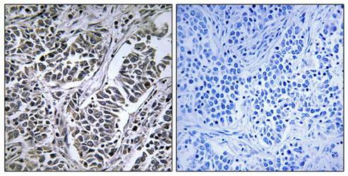 ATP5D Antibody
