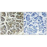 ATP5G2 Antibody