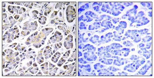 ATP5G3 Antibody