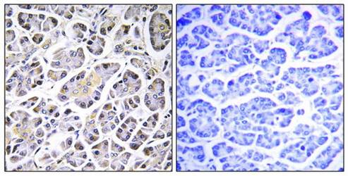 ATP5G3 antibody