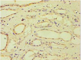 ATP5J Antibody