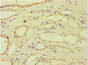 ATP5J antibody