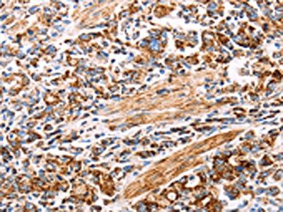 ATP5J Antibody