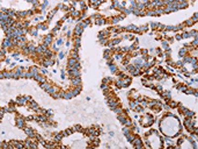 ATP5J Antibody