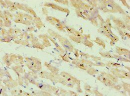 ATP5O Antibody