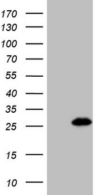 ATP5PO Antibody
