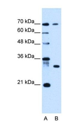 ATP6AP1L antibody