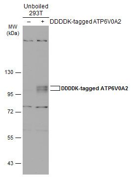 ATP6V0A2 antibody [N2C1], Internal