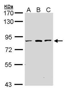 ATP6V0A2 antibody