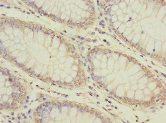 ATP6V0D1 Antibody