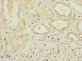 ATP6V0D1 Antibody