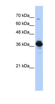 ATP6V0D2 antibody