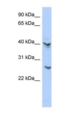 ATP6V0E2 antibody
