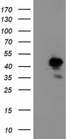ATP6V1B1 antibody