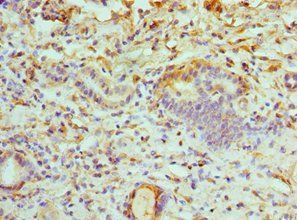 ATP6V1B1 Antibody