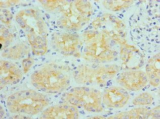 ATP6V1B1 Antibody